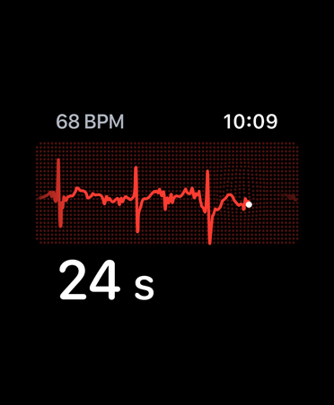 App ECG, battements par minute dans le coin supérieur gauche, ligne de fréquence, minuterie