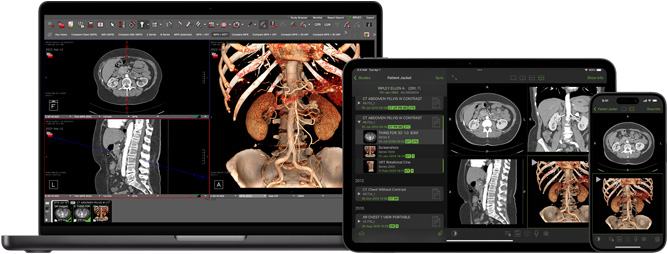 Écran affichant l’app Visage, que les radiologues utilisent pour interpréter des fichiers de diagnostic volumineux.