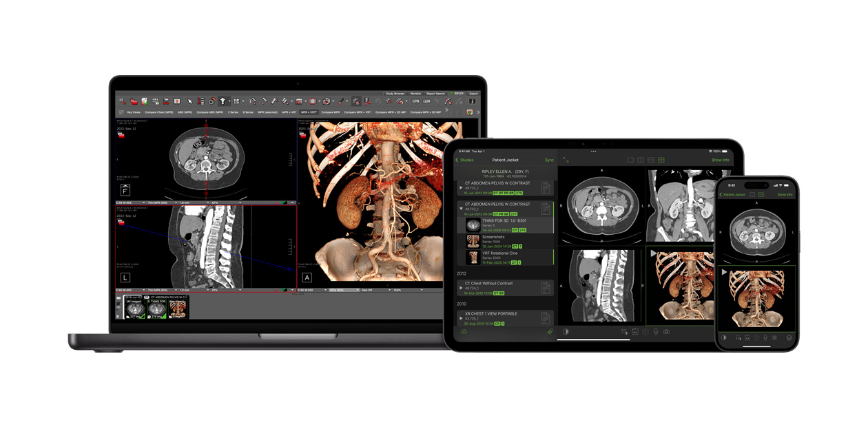 Écran affichant l’app Visage, que les radiologues utilisent pour interpréter des fichiers de diagnostic volumineux.